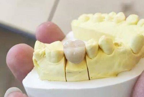 技术加持：为治疗终点保驾护航