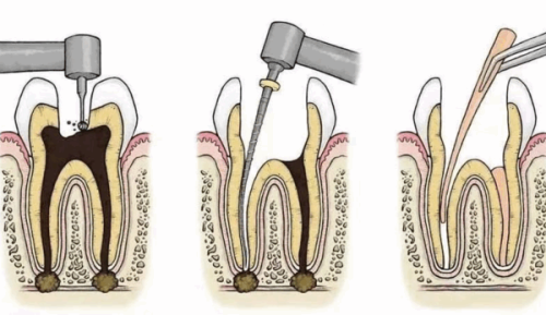 山东济南乐雅口腔怎么样？