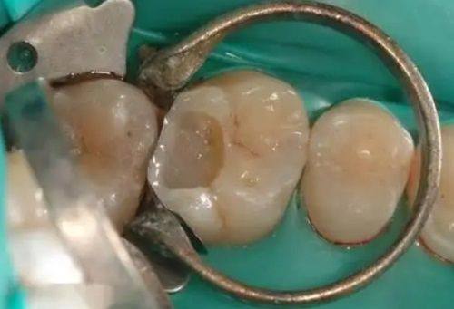 湛江徐闻牙优口腔口碑评价: