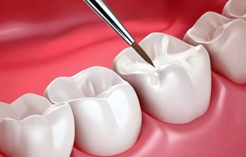 宁波王鑫明口腔诊所价格表：