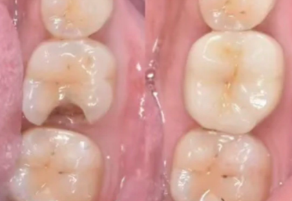 常州武进金铂利口腔医院医生名单及擅长领域：