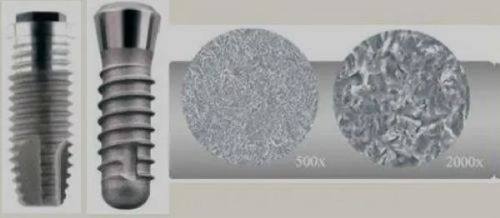 三、这类补牙/修复材料，会干扰核磁共振成像