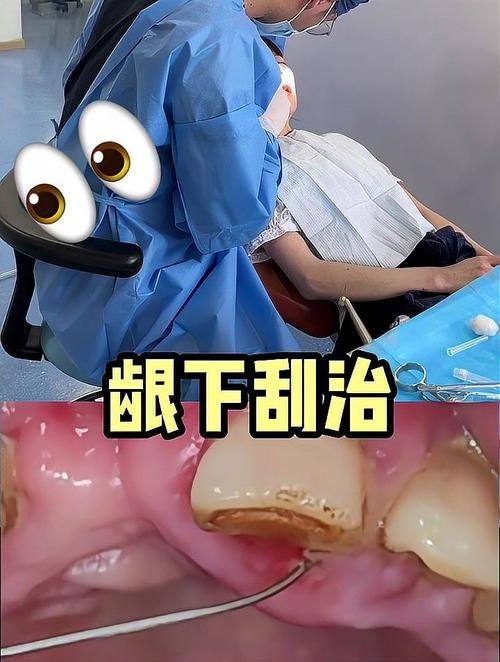 恒牙康口腔擅长项目：