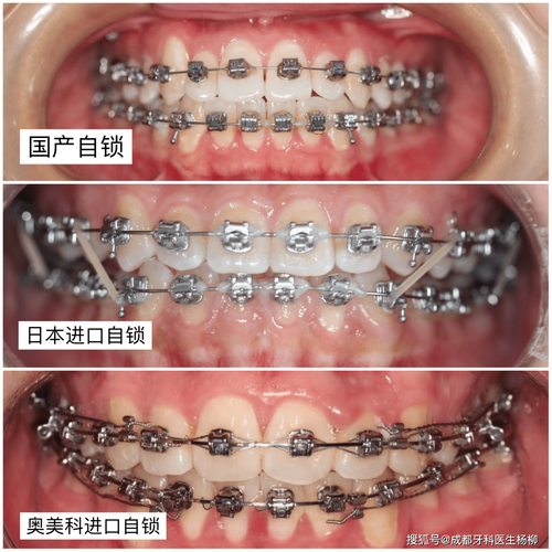 耒阳市顺菊湘南口腔诊所地址电话及营业时间