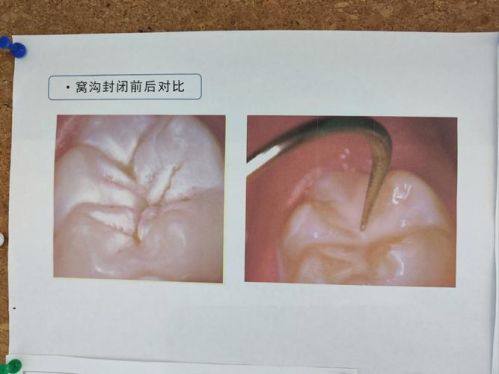 深圳诺德松柏口腔门诊部医生名单及擅长领域：