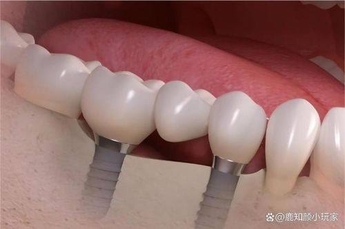 湖南郴州嘉禾弘德口腔口碑评价: