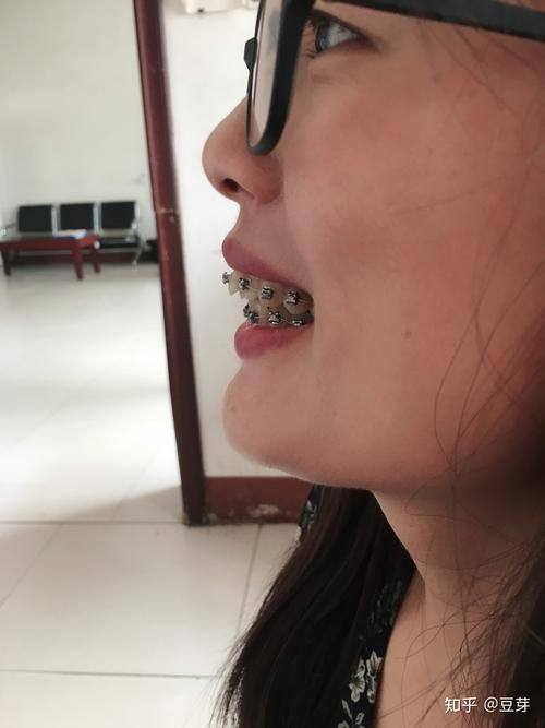 重庆巴南刘洋口腔诊所预约挂号方式：