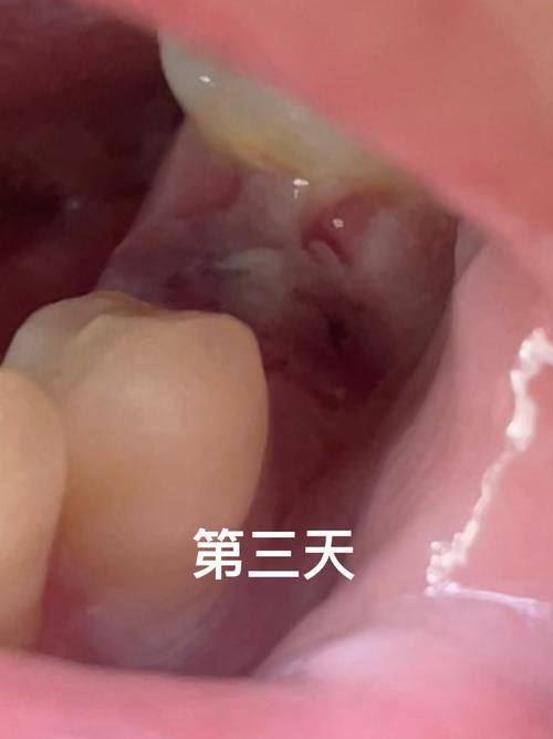 株洲市新南光口腔(罗国淑口腔诊所)价格表