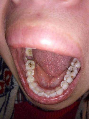 重庆巴南刘洋口腔诊所地址电话及营业时间：