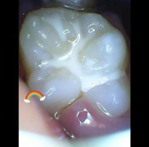 湖南郴州嘉禾弘德口腔擅长项目: