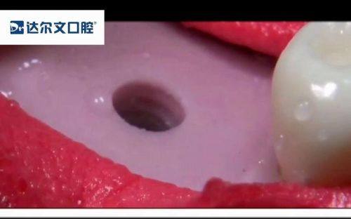 襄阳奥益齿口腔诊所擅长项目: