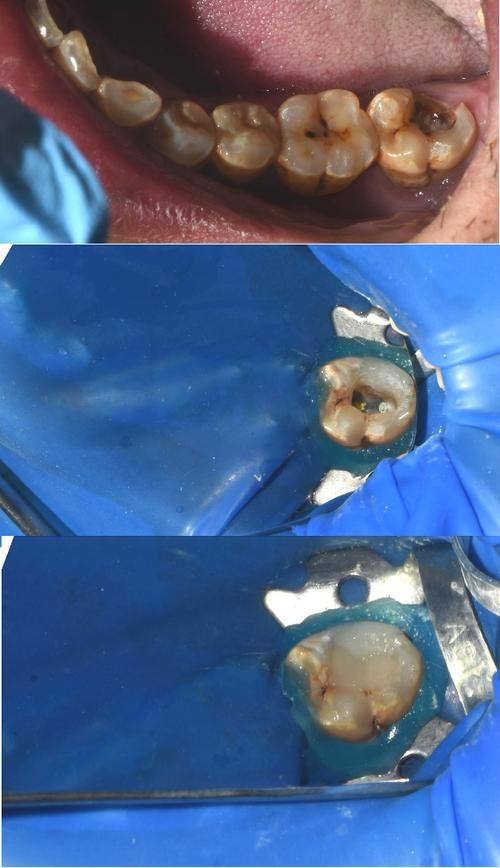 南京优佳口腔预约挂号方式