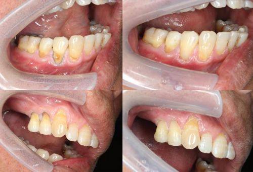 襄阳奥益齿口腔诊所口碑评价: