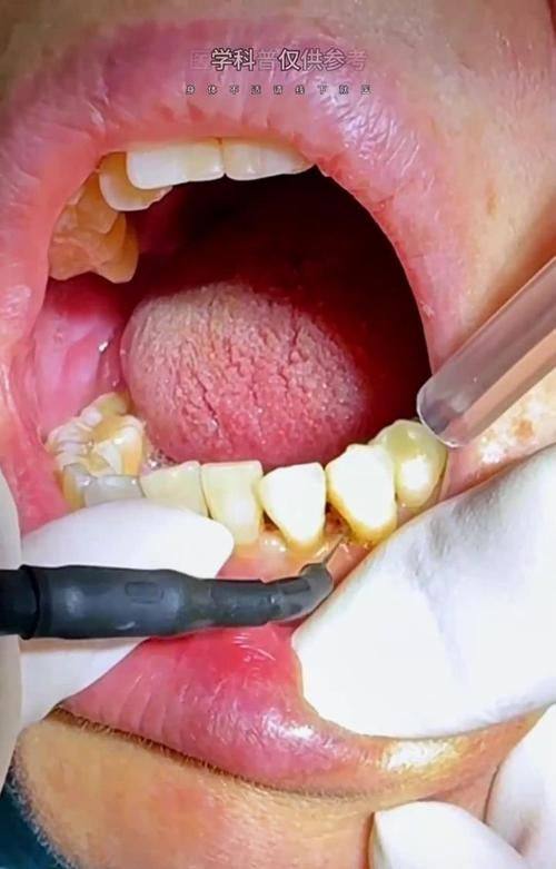 国内中医 科学 院望京医院口腔科口碑评价：