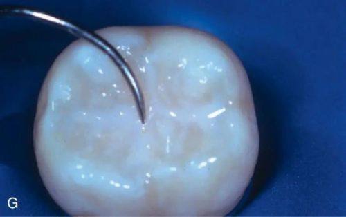 国内中医 科学 院望京医院口腔科预约挂号方式：