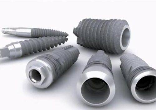 二、窝沟封闭材料的常见类型及区别