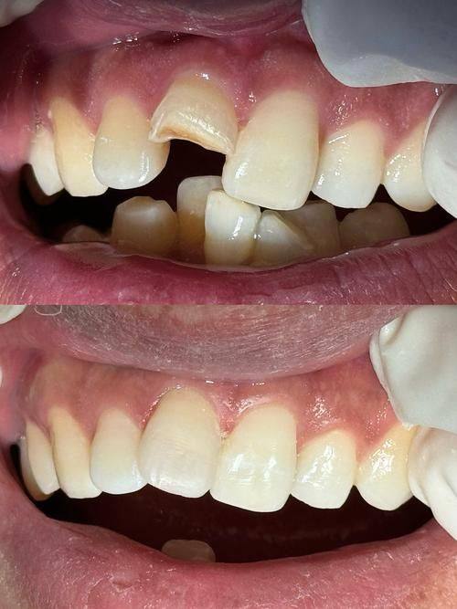 潜江市姚治豹口腔诊所医生名单及擅长领域：