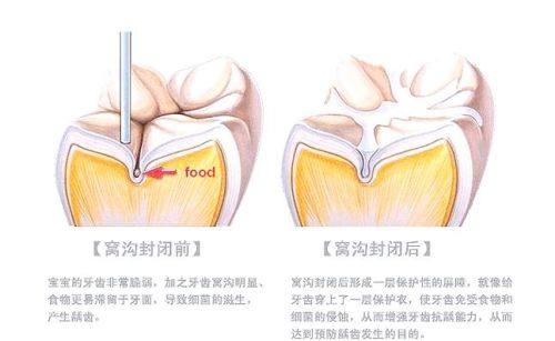扬州仪征文莱口腔诊所擅长项目：