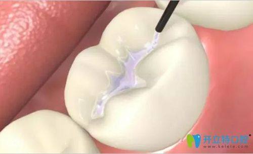 内江启辰口腔(隆昌店)擅长项目：