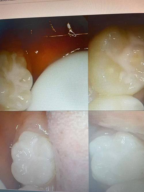 珠海南坊口腔门诊部价格表