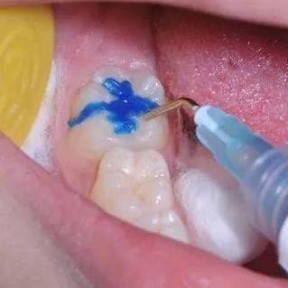 广东惠州惠康口腔擅长项目：