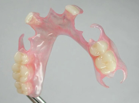 一、标准流程:根管充填,完成根管系统的“终极密封”