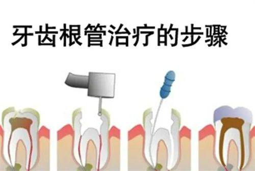 陕西榆林市高新区恒舒口腔口碑评价