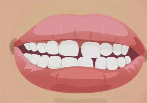 五、成年地包天矫正的关键注意事项