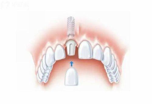 南宁牙未来口腔医院价格表