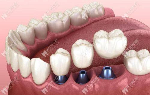 沧州市中 心医院口腔门诊口碑评价：