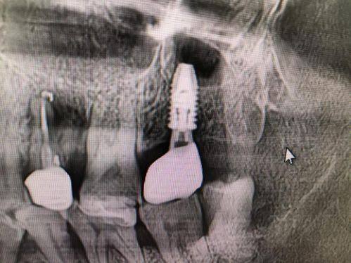 宁波诚适口腔(高新门诊部)地址电话及营业时间
