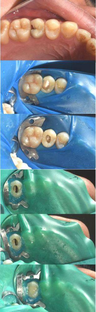广东江门台山张学军口腔预约挂号方式：
