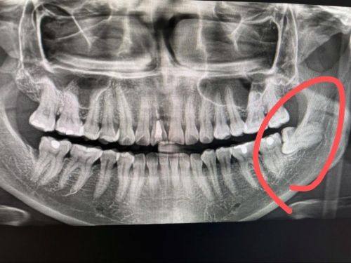 南宁牙未来口腔医院口碑评价