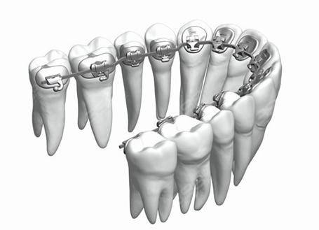 宁波诚适口腔(高新门诊部)擅长项目：