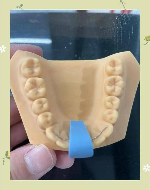 陕西榆林市高新区恒舒口腔擅长项目：