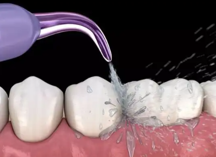 地包天要怎么矫正视频｜含不同类型方案、黄金矫正年龄、成人矫正及费用参考