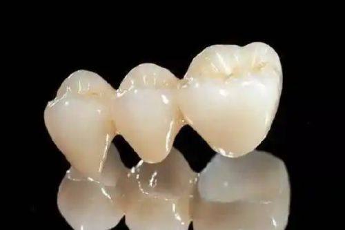 四、3M树脂和普通树脂补牙的区别