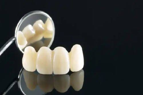 五、烤瓷牙做CT有影响吗？关键看材质和检查部位