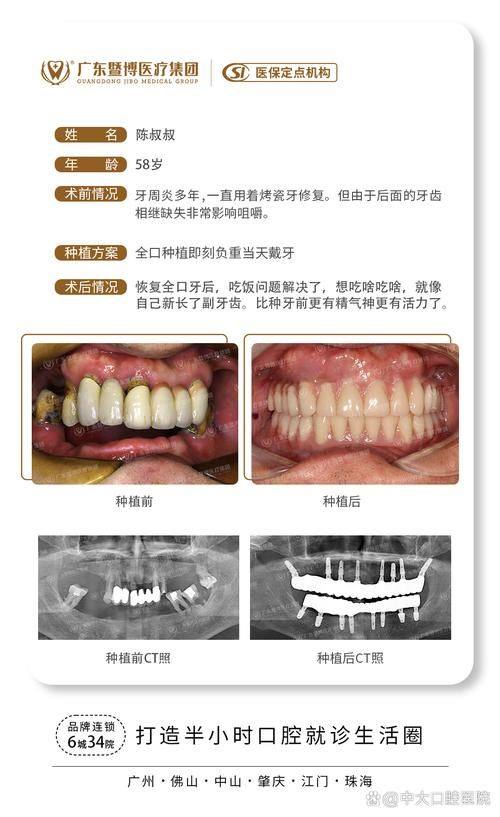 渭南高新友道口腔医生名单及擅长领域：
