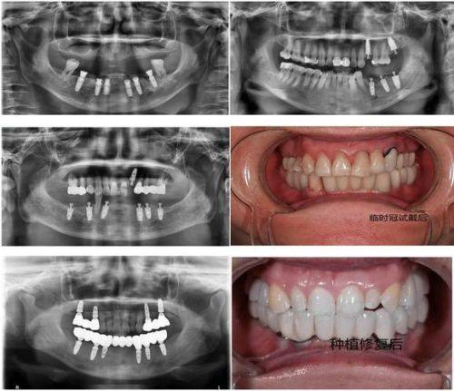 湖南株洲醴陵明固口腔擅长项目: