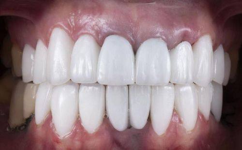 北京欢乐团结口腔门诊部怎么样?