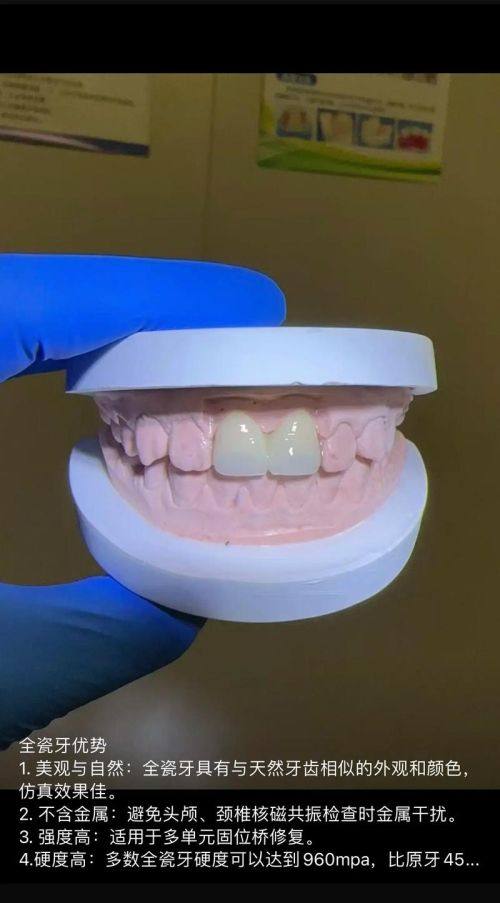 兰山李玉鹤口腔诊所口碑评价