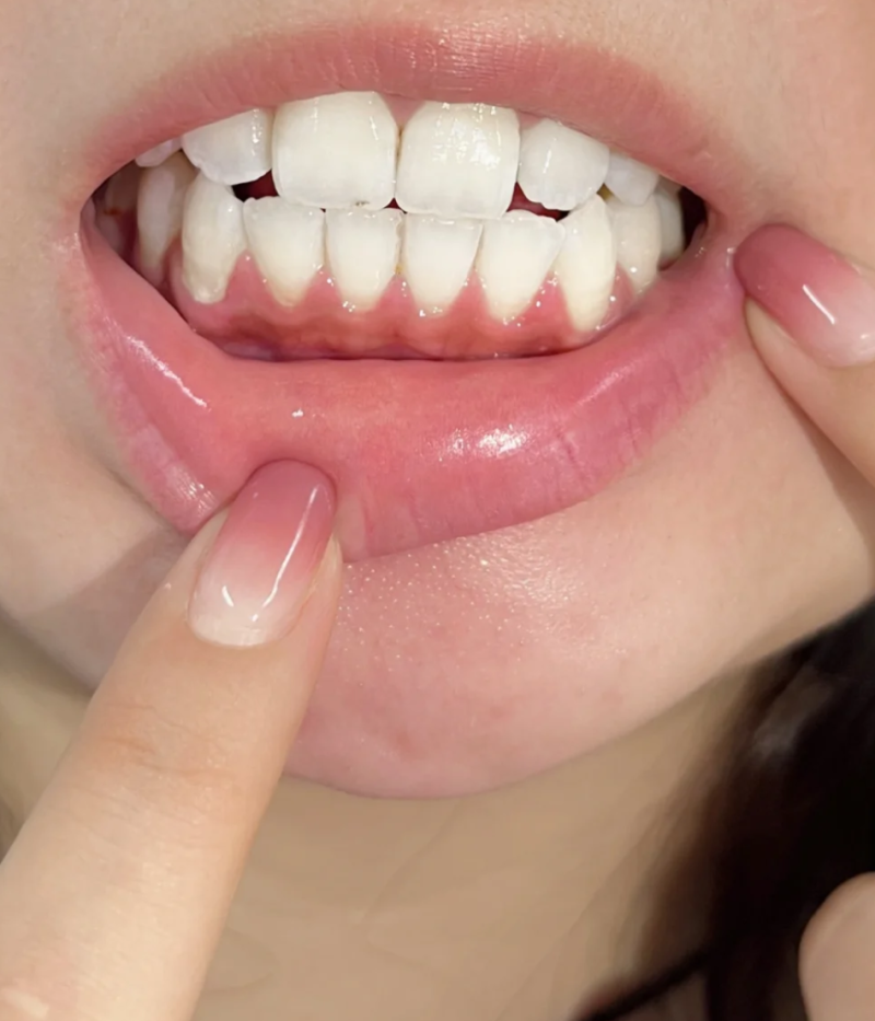 五、临床靠谱医生与真实矫正实例参考