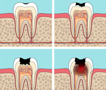 五、用药与疼痛管理：科学缓解不适