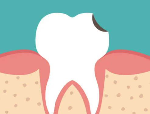 四、小苏打洗牙的副作用与注意事项