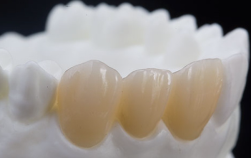 四、关于牙神经治疗的常见疑问解答