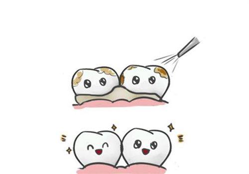 二、不同补牙材料的脱落风险与维持时长差异