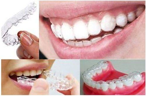 二、哪些情况必须做根管治疗