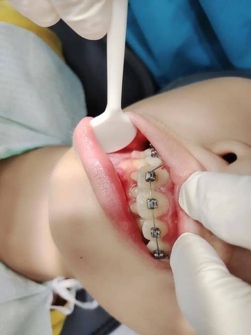 云南大理诚康口腔连锁预约挂号方式