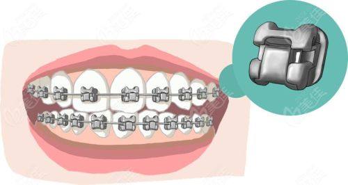 宜都雅美口腔门诊部擅长项目: